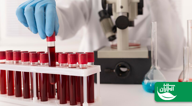 روشهای آزمایشگاهی تشخیص کمخونی